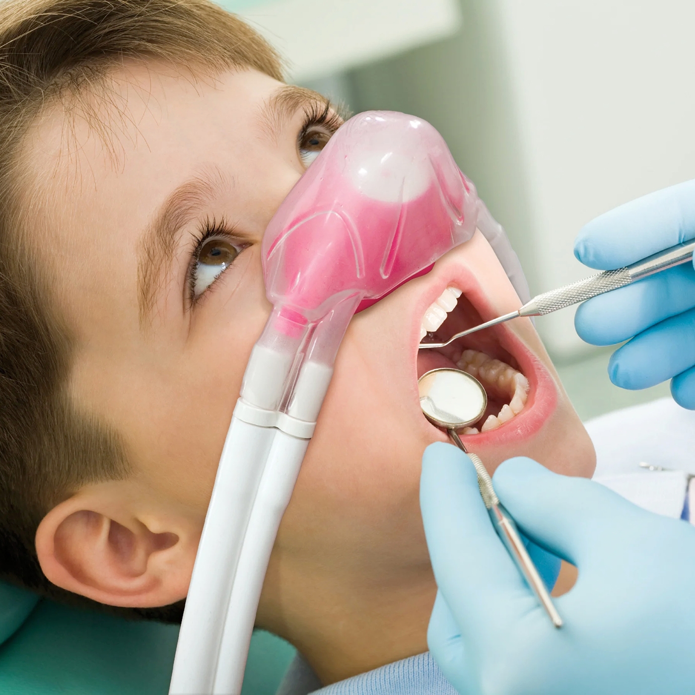 sedation-dentistry-for-children-1
