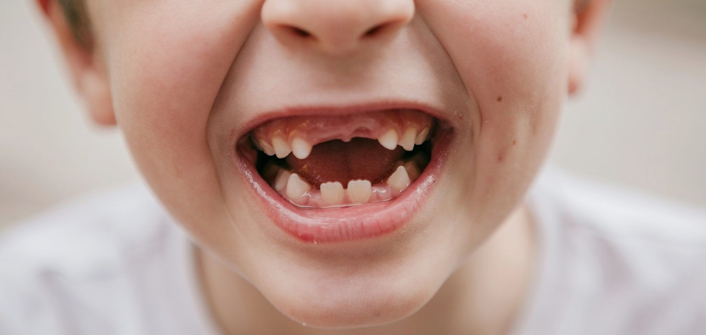 teeth missing from childs mouth