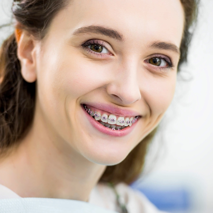Braces For Adults Santa Clarita, California Kidz Dental Care SCV and PR