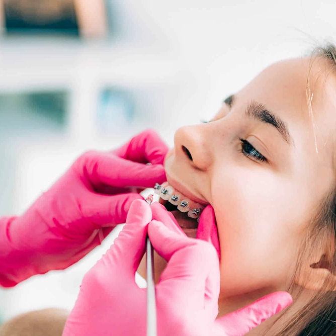 Orthodontic Emergencies Santa Clarita, California Kidz Dental Care